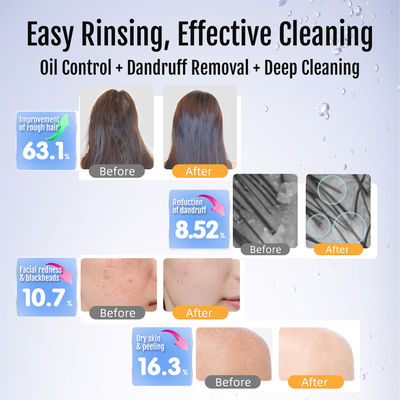 Ultra-Fine Nano Bubble Generator voor Spa & Beauty Waterstofrijke diepe huidreiniging & zuurstoftherapie machine